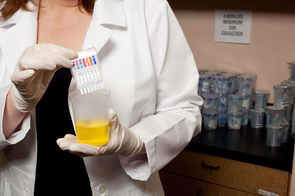 Medical professional conducting a drug test