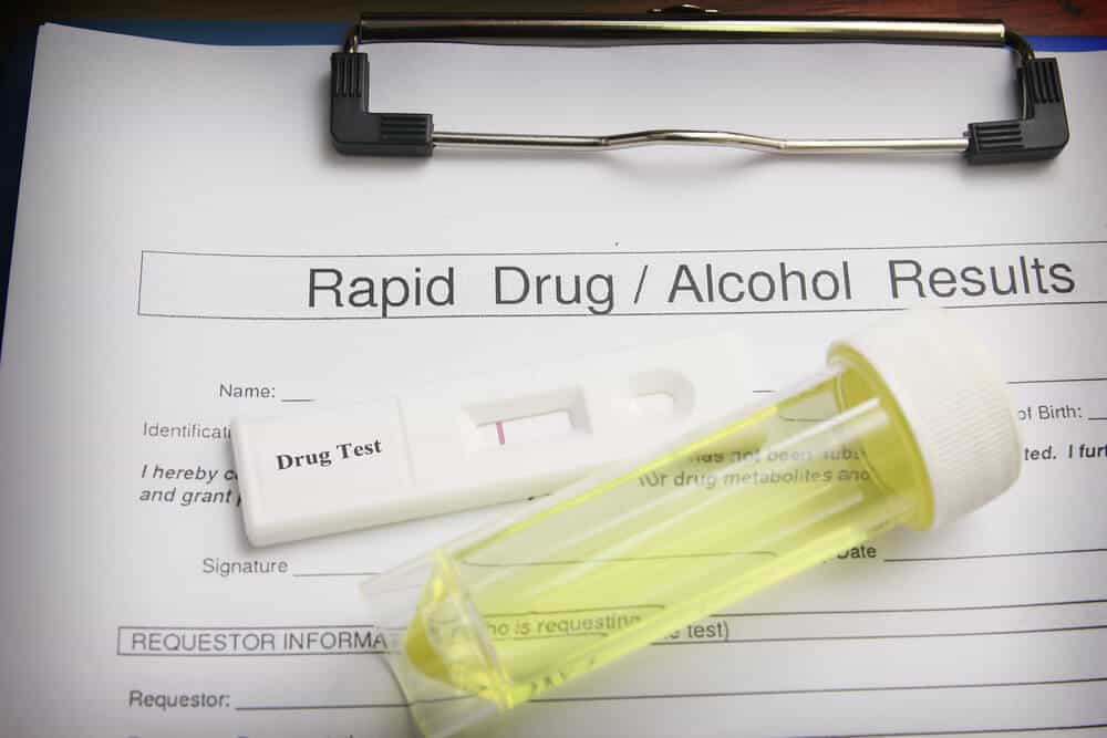 Laboratory drug screening process
