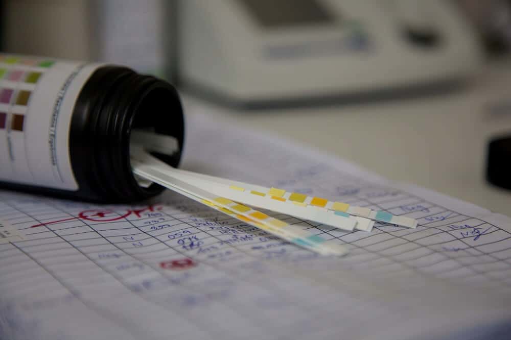Drug test – What is it, how is it done and how reliable is it?